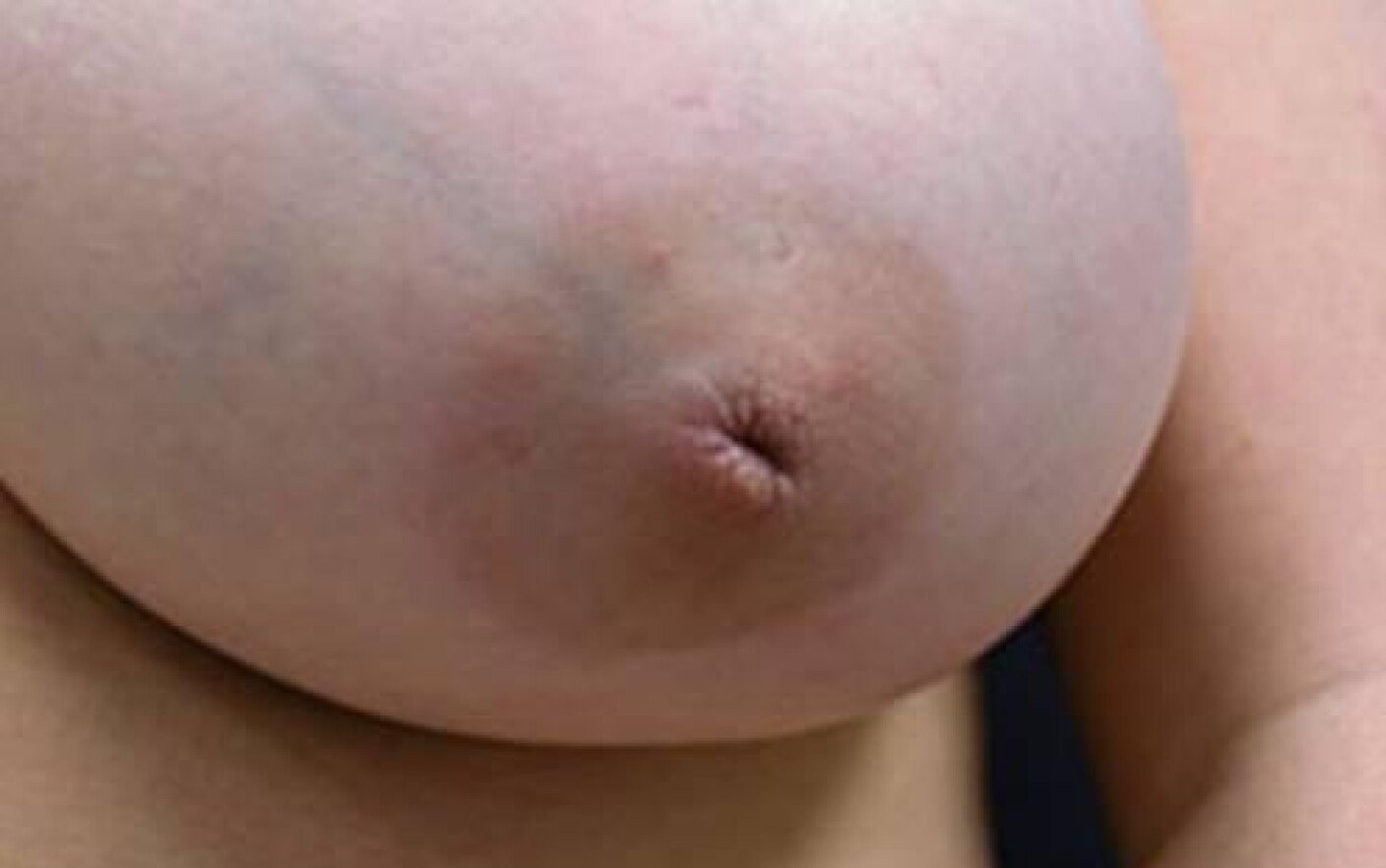 беременность грудь цвет сосков фото 101