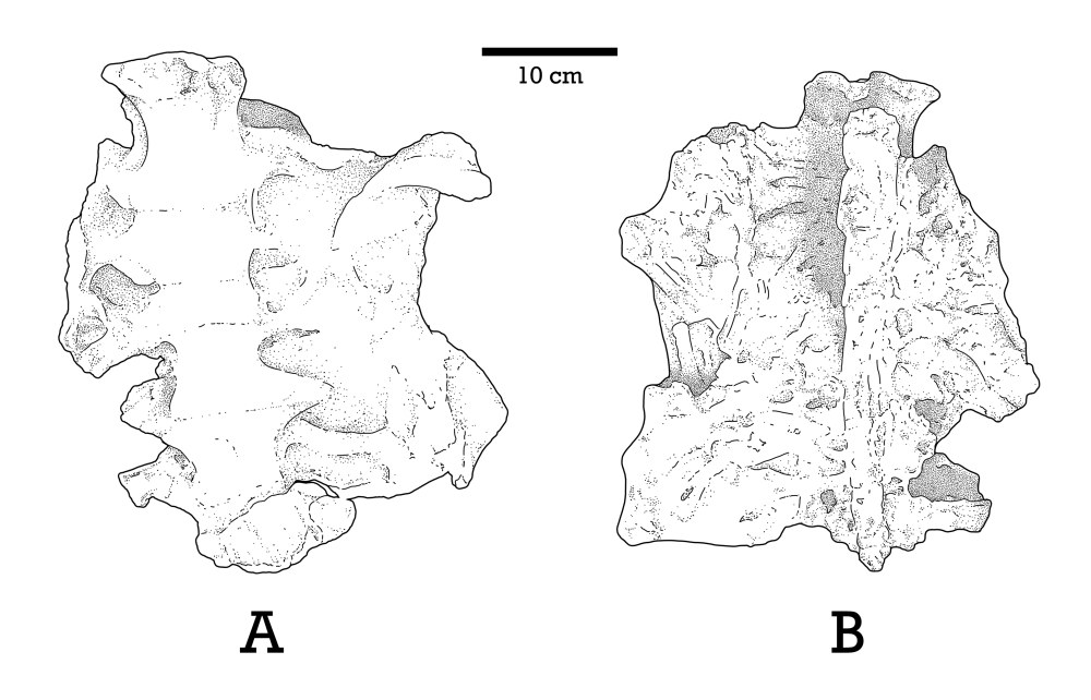 Вырезка вертлужной впадины