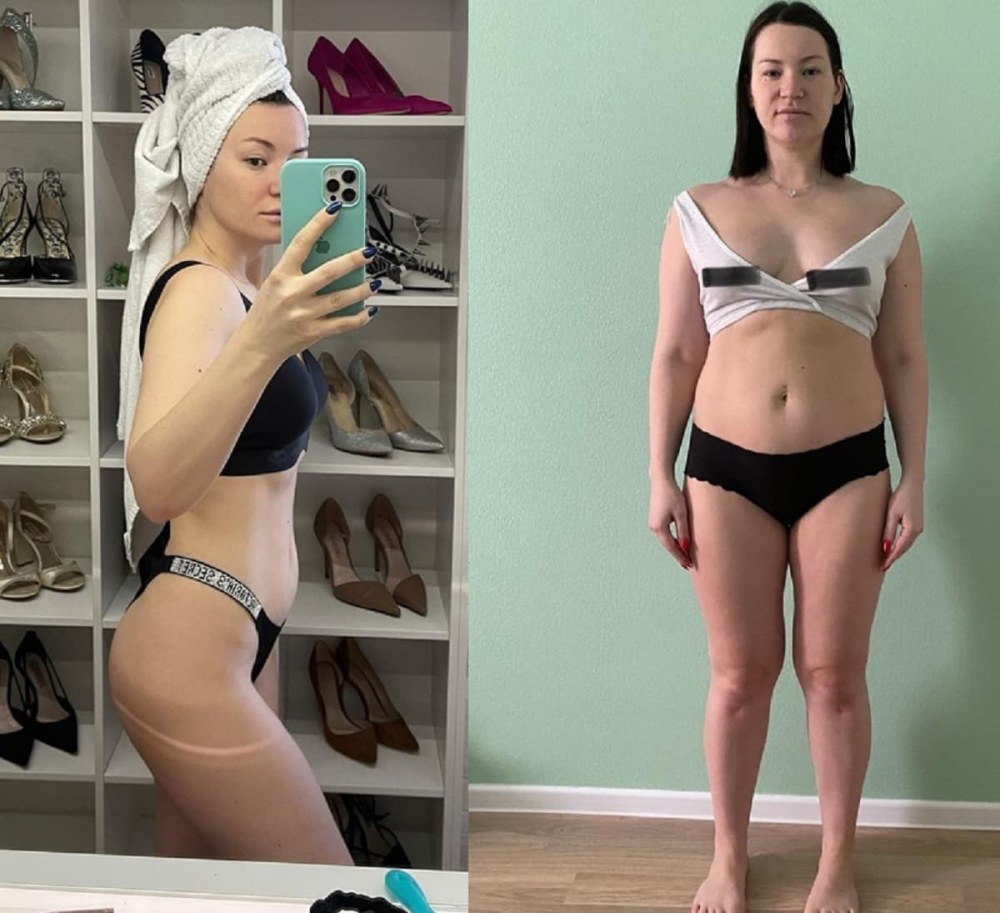 Симона Андерсон до и после похудения