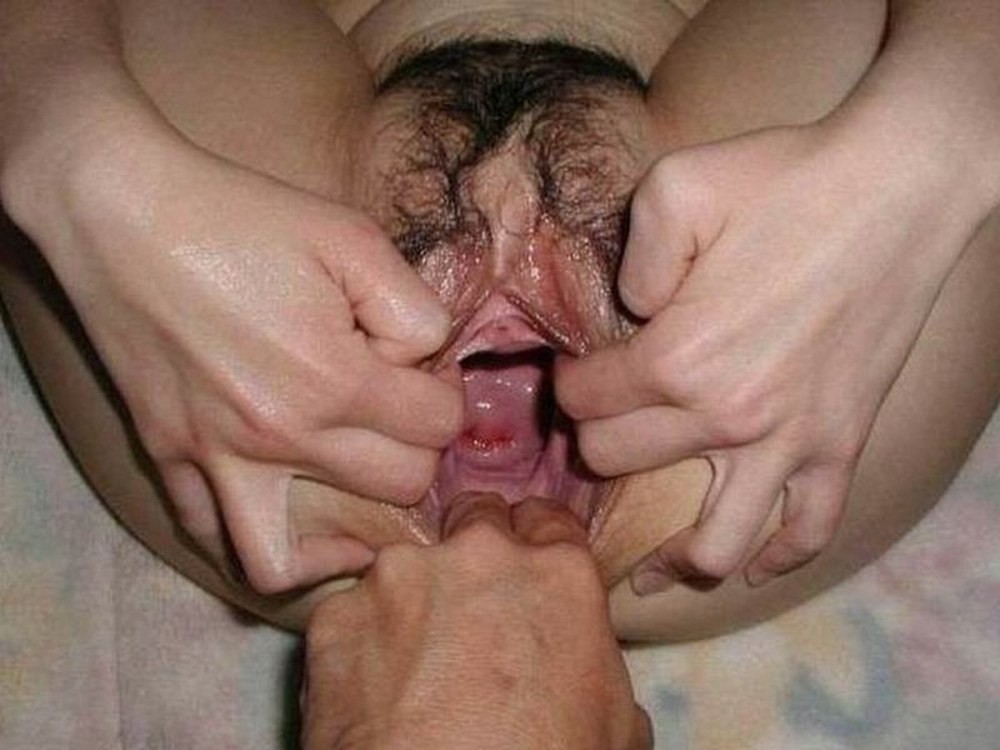 Изабелла Кларк пролапс