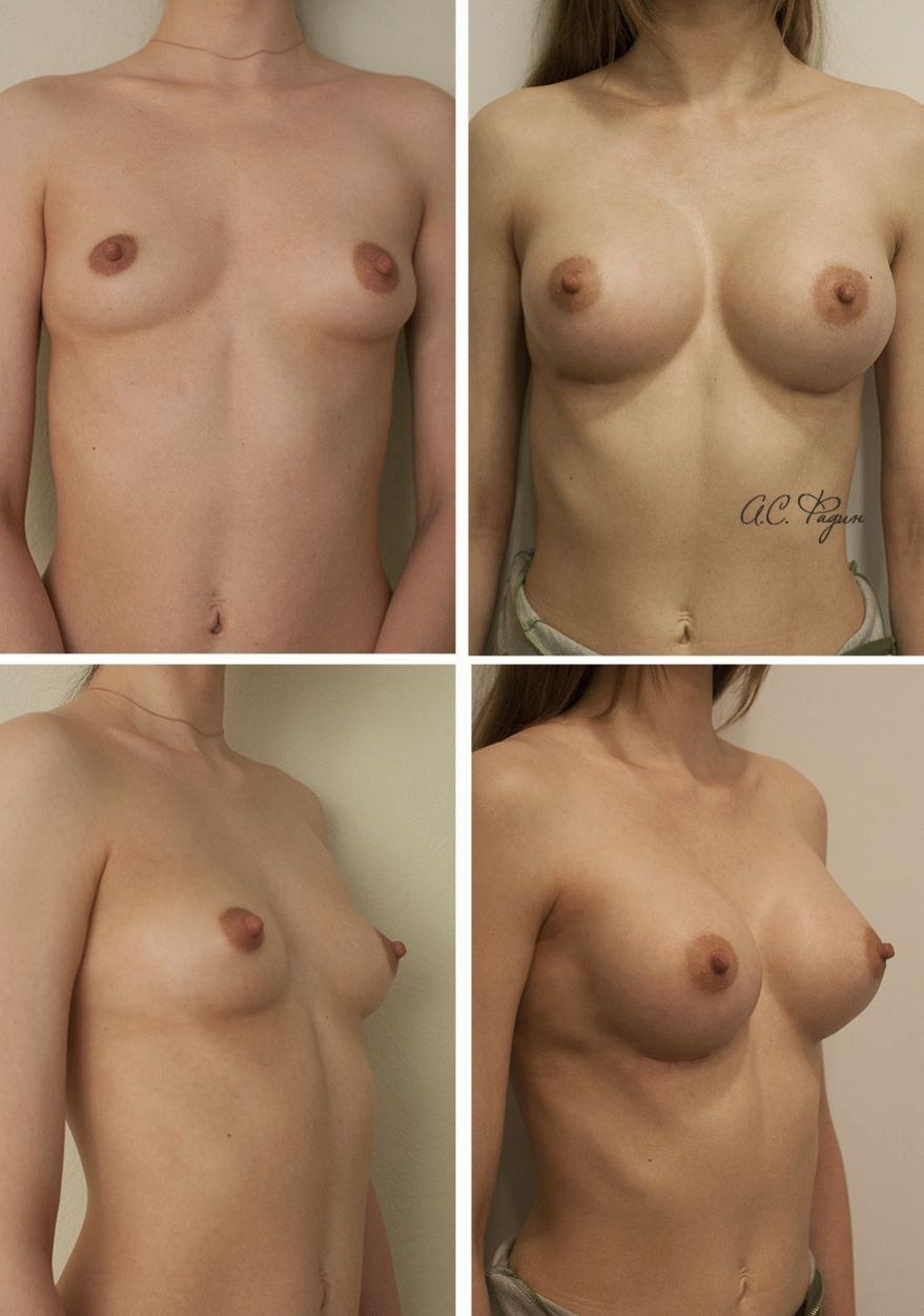 от секса увеличивается грудь у женщин фото 116