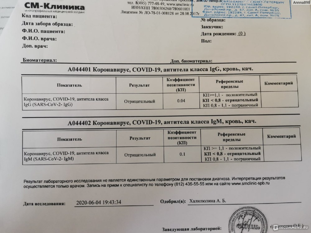 Велосипед вид спереди чертеж