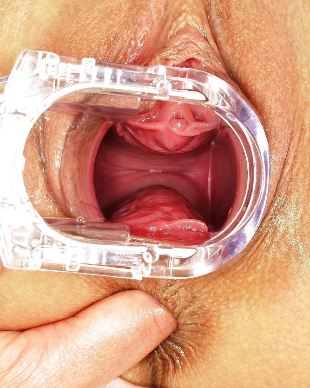 Suzie Carina вагинальный расширитель