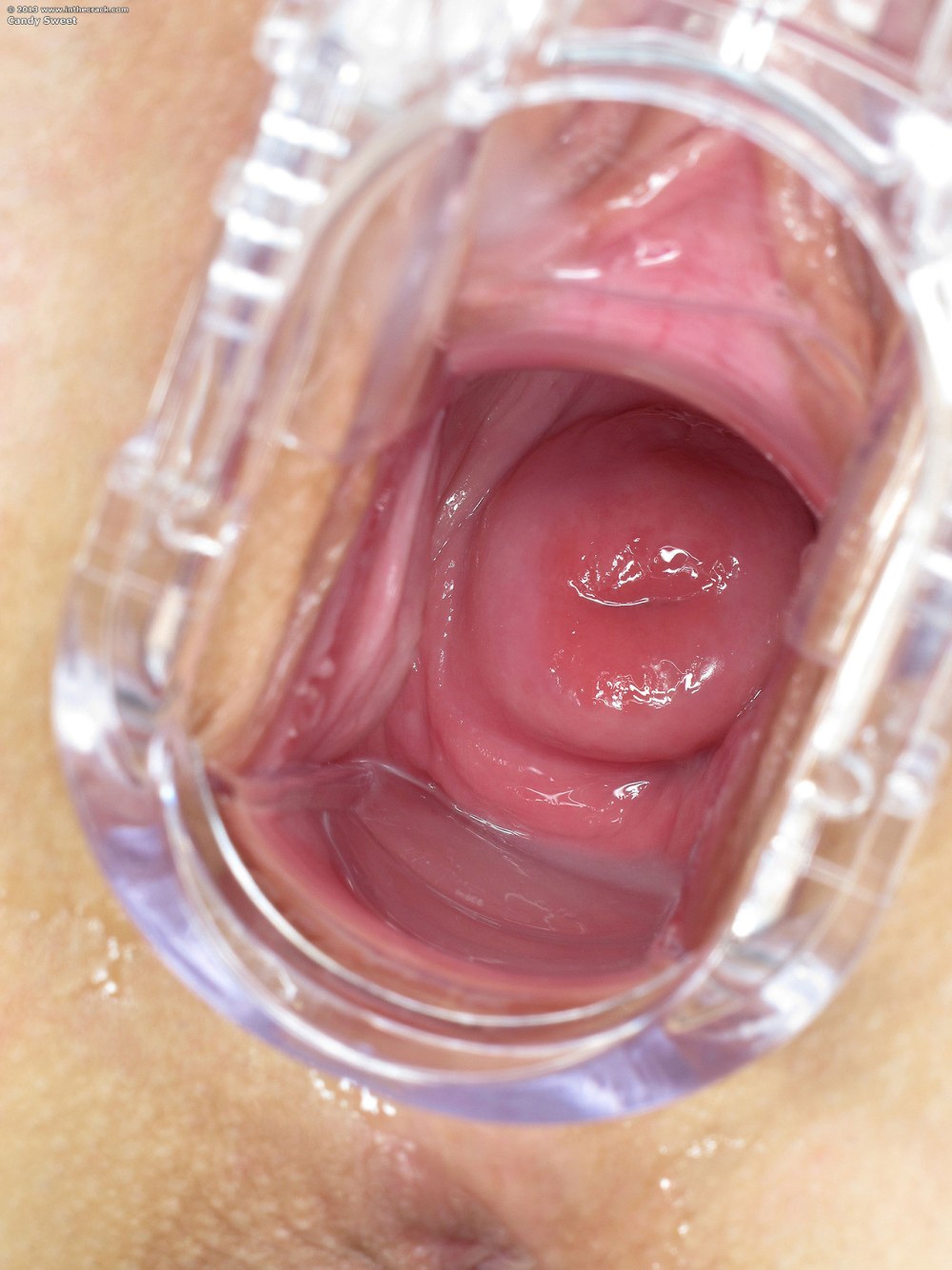 Женское влагалище внутри