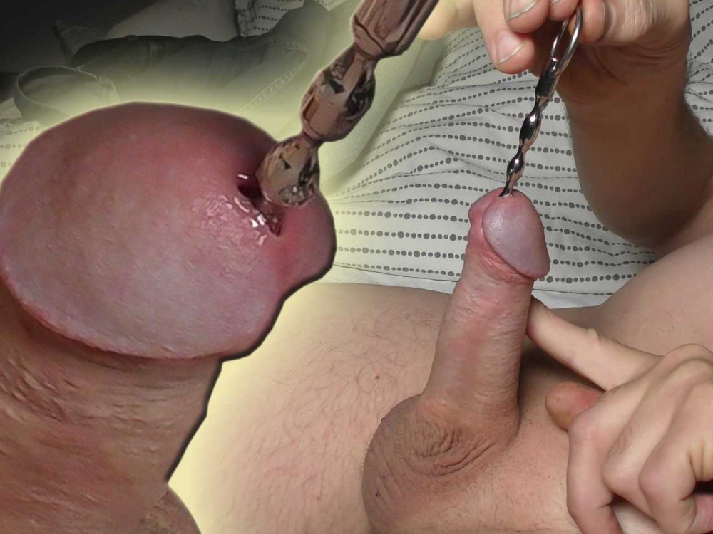 Циркумцизия бдсм женская