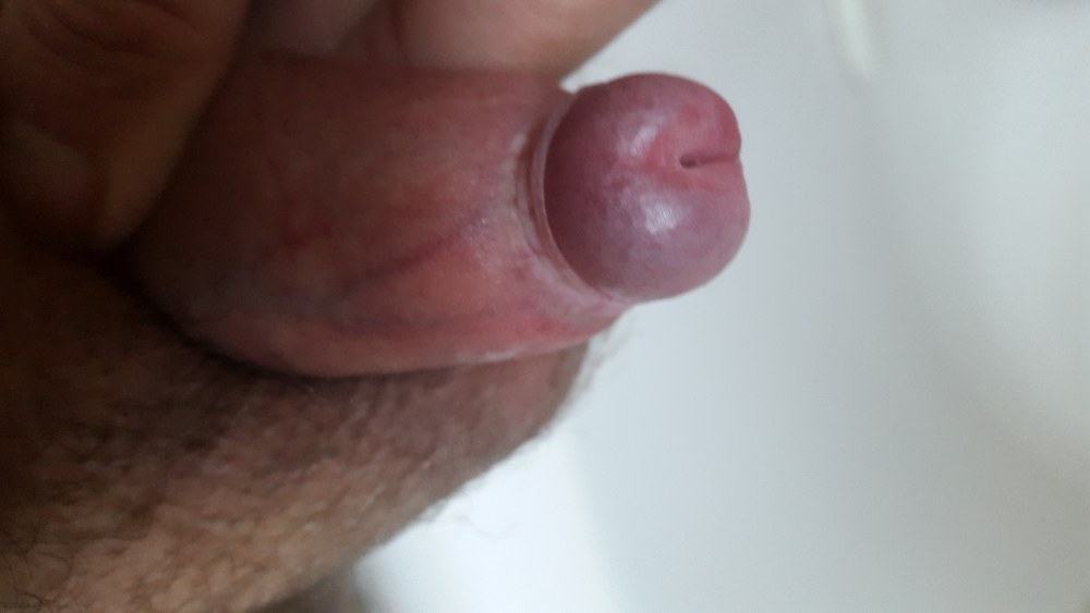 Strip and Play with foreskin phimosis cock