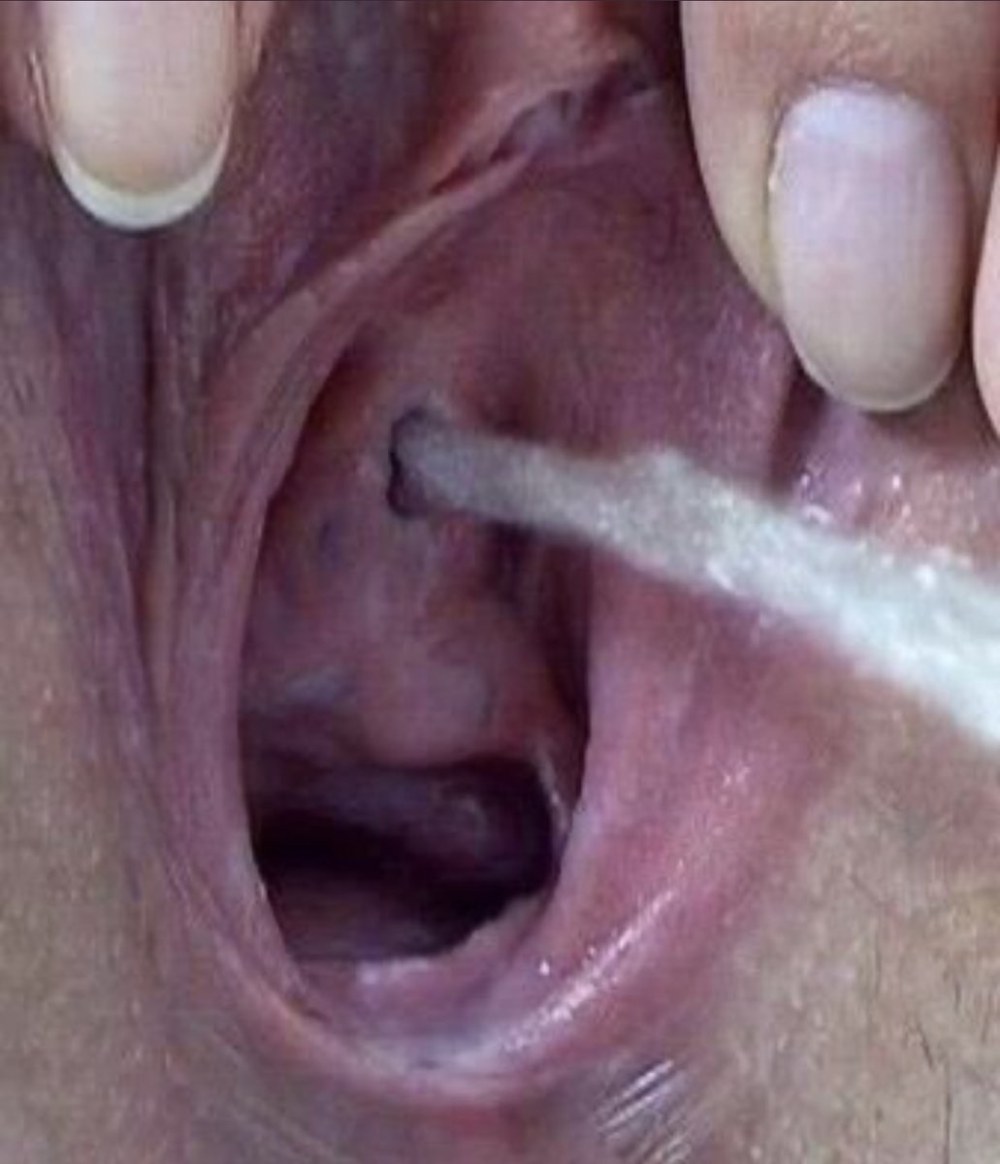 Женская уретра крупным